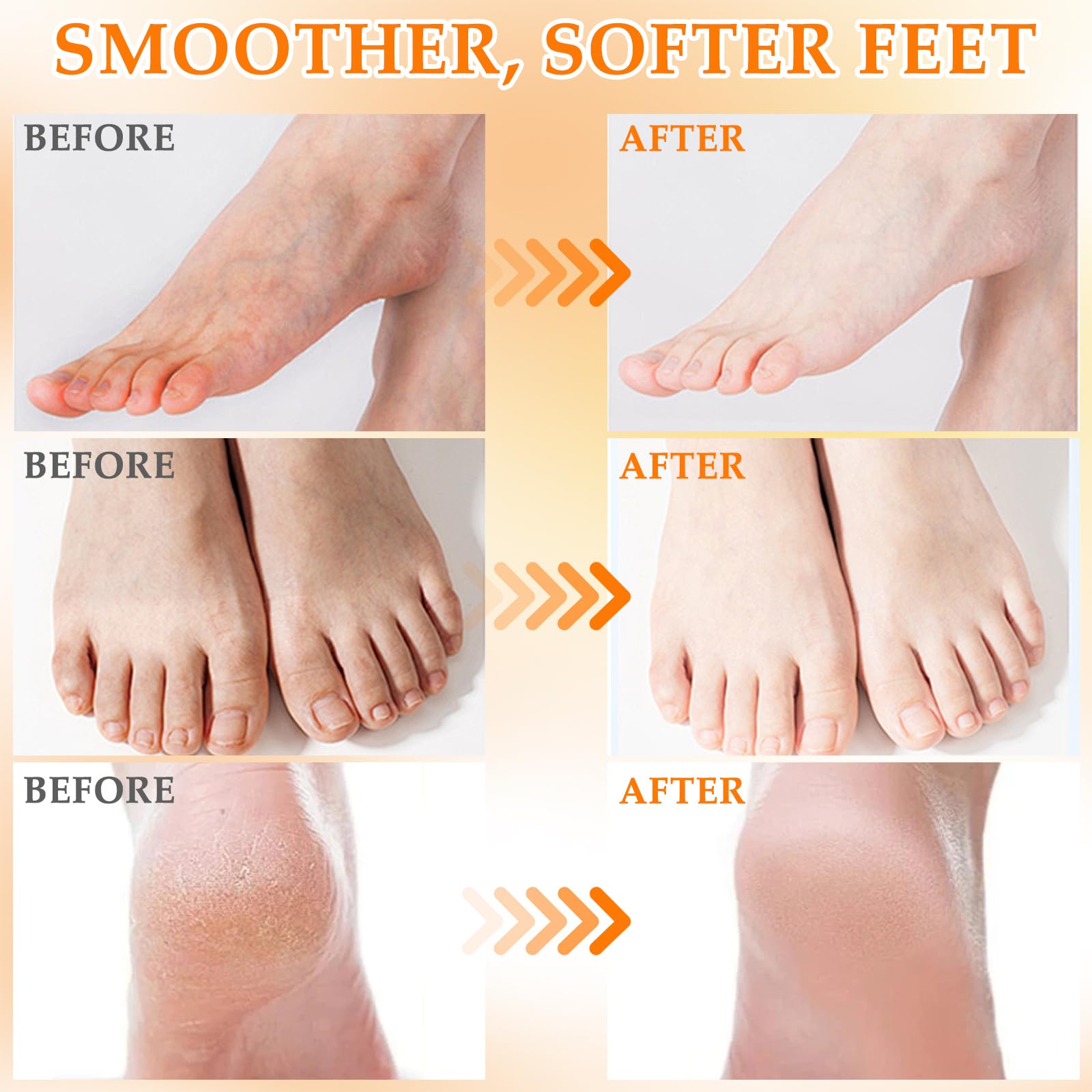 Masque Pied Exfoliant 6 Paires – Chaussettes Exfoliantes Anti-Cornes avec 2x Coco, Fraise & Miel – Soin des Pieds Doux pour Talons Secs et Crevassés, Hydratant, Spa à Domicile Femme & Homme