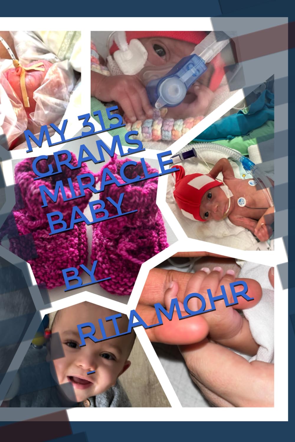My 315 Grams Miracle Baby: Tiny but Mighty, A Premature baby's fight for life