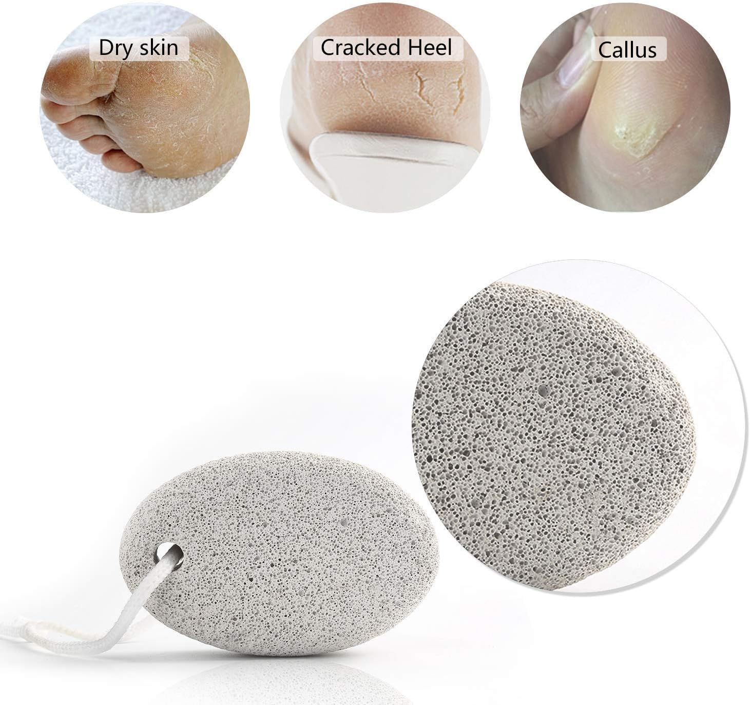 Keli Natural Pumice Stone for Feet Lava Pedicure Tools Callus Remover for Feet and Hands Natural Foot File Exfoliation to Remove Dead Skin, Heels, Elbows, Hands (1 Pcs Pumice Stone Big Size 10.5x7x3.5 cm) 3