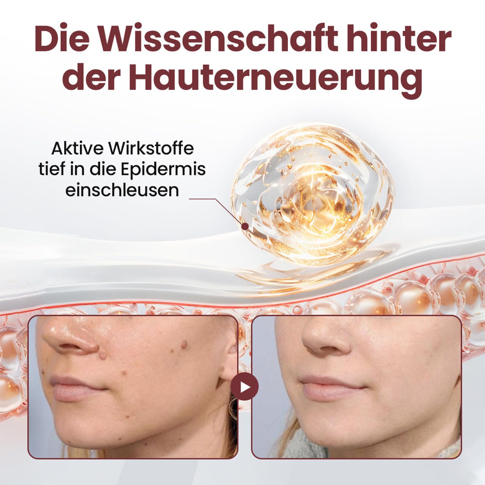 Biancat KeraErase Dual-Action Erneuerungscreme, Biancat Warzen und Hautwucherungen Entfernen Creme, Natürlich KeraErase Hautreparaturcreme, für Aller Hauttypen (1 Stück)