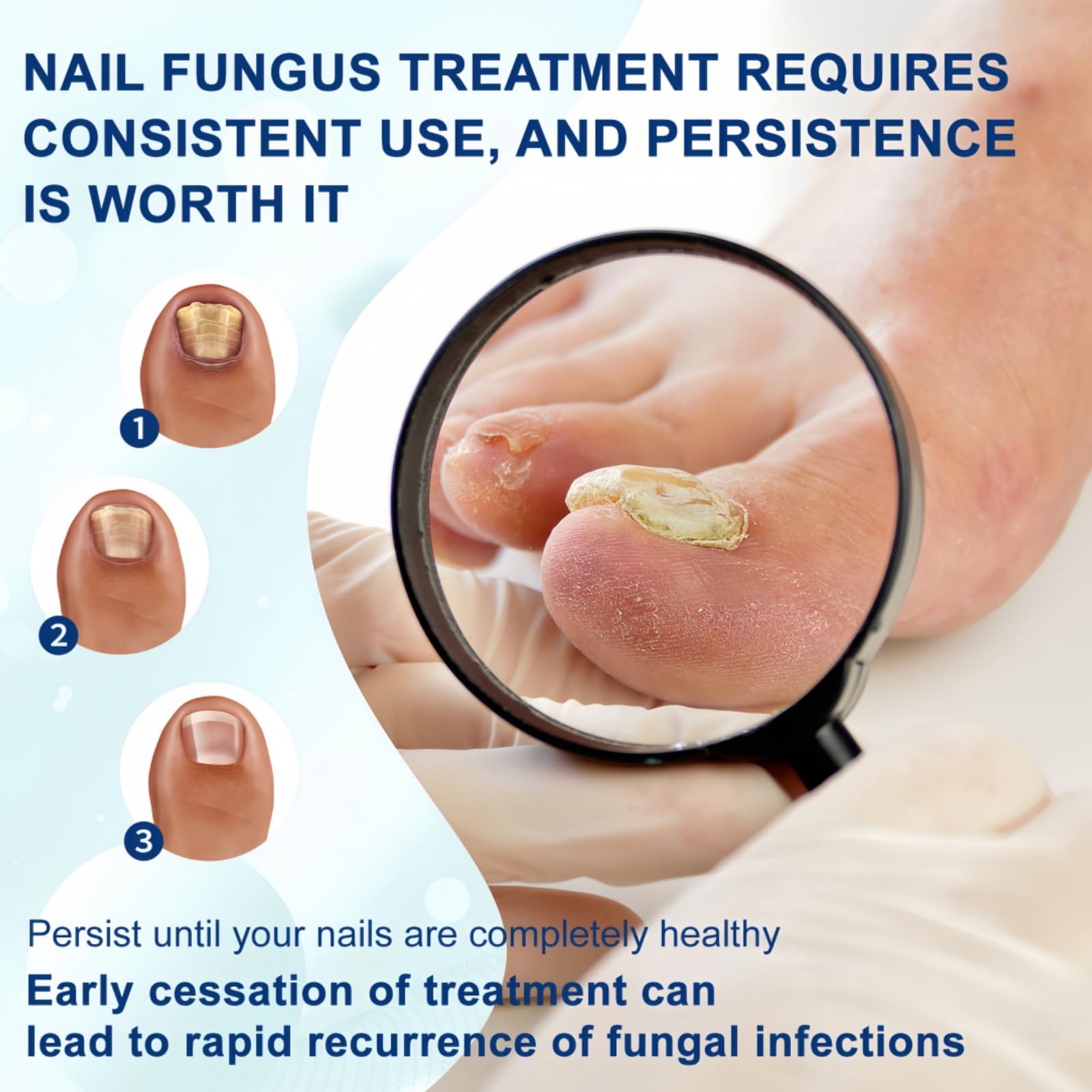 4Pcs Fungal Nail Treatment Pens, Effective Fingernai & Toenail Fungus Treatment and Repair Essence - Image 3