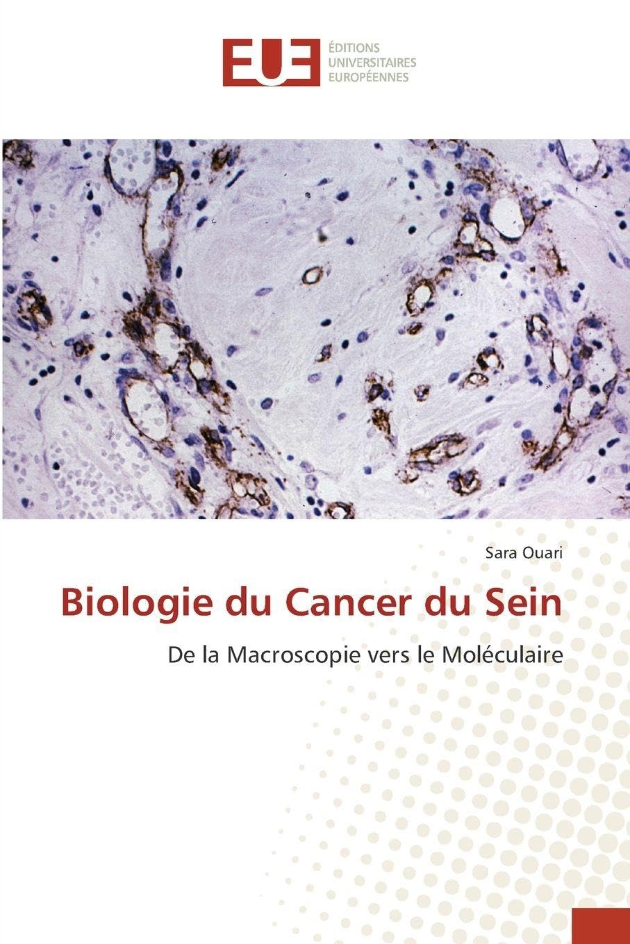 Biologie du Cancer du Sein: De la Macroscopie vers le Moléculaire