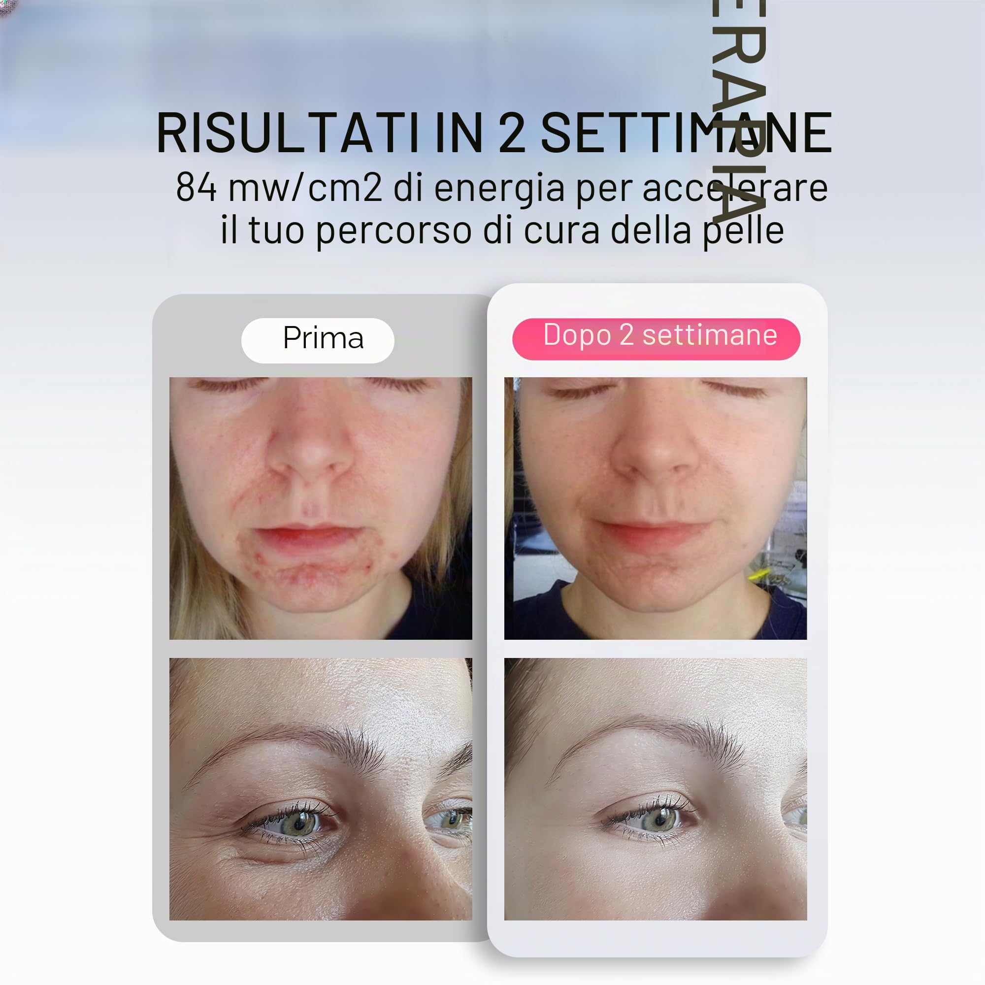 Maschera Facciale LED per Viso, Collo e Décolleté, Terapia della Luce nel Vicino Infrarosso, Maschera di Bellezza in Silicone Flessibile, Trattamento Domiciliare, Cura della Pelle (Bianco)