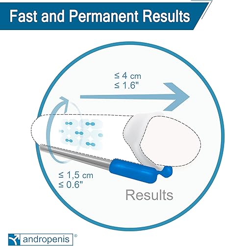 Miniatura 4 de Andromedical Sistema de ampliación eficaz del extensor de tracción