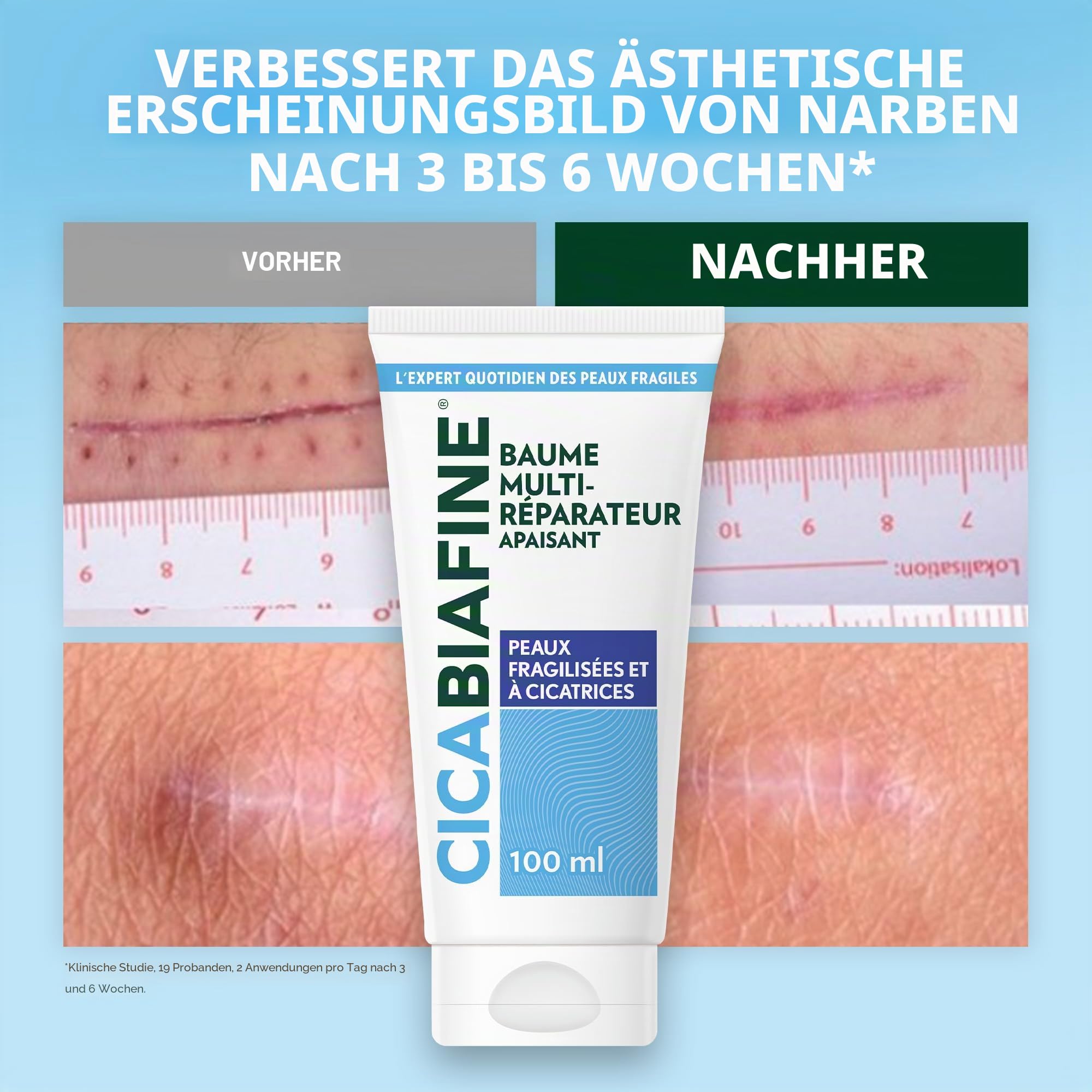 Cicabiafine | Beruhigender Multi-Reparatur-Balsam (100 ml Tube) - Repair Balsam für geschädigte Haut mit Narben - Beruhigender Balsam zur Verbesserung des Aussehens von Narben
