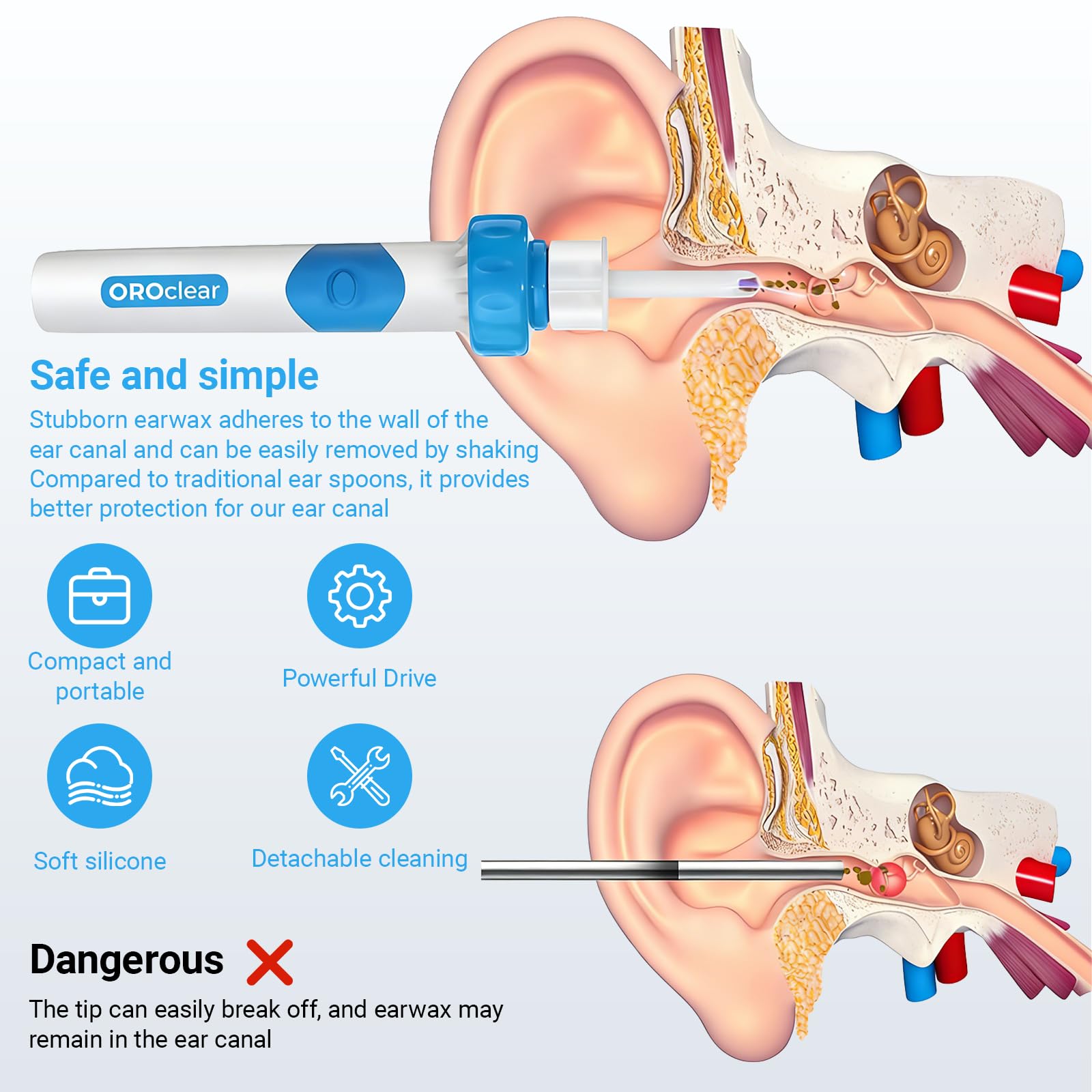 Extracteur de Cérumen Électrique,Appareil De Nettoyage Des Oreilles Pour Bebe Enfants Adulte Avec 2 Têtes de Rechange Lavables et Brosse(Utiliser Batterie NO.7)