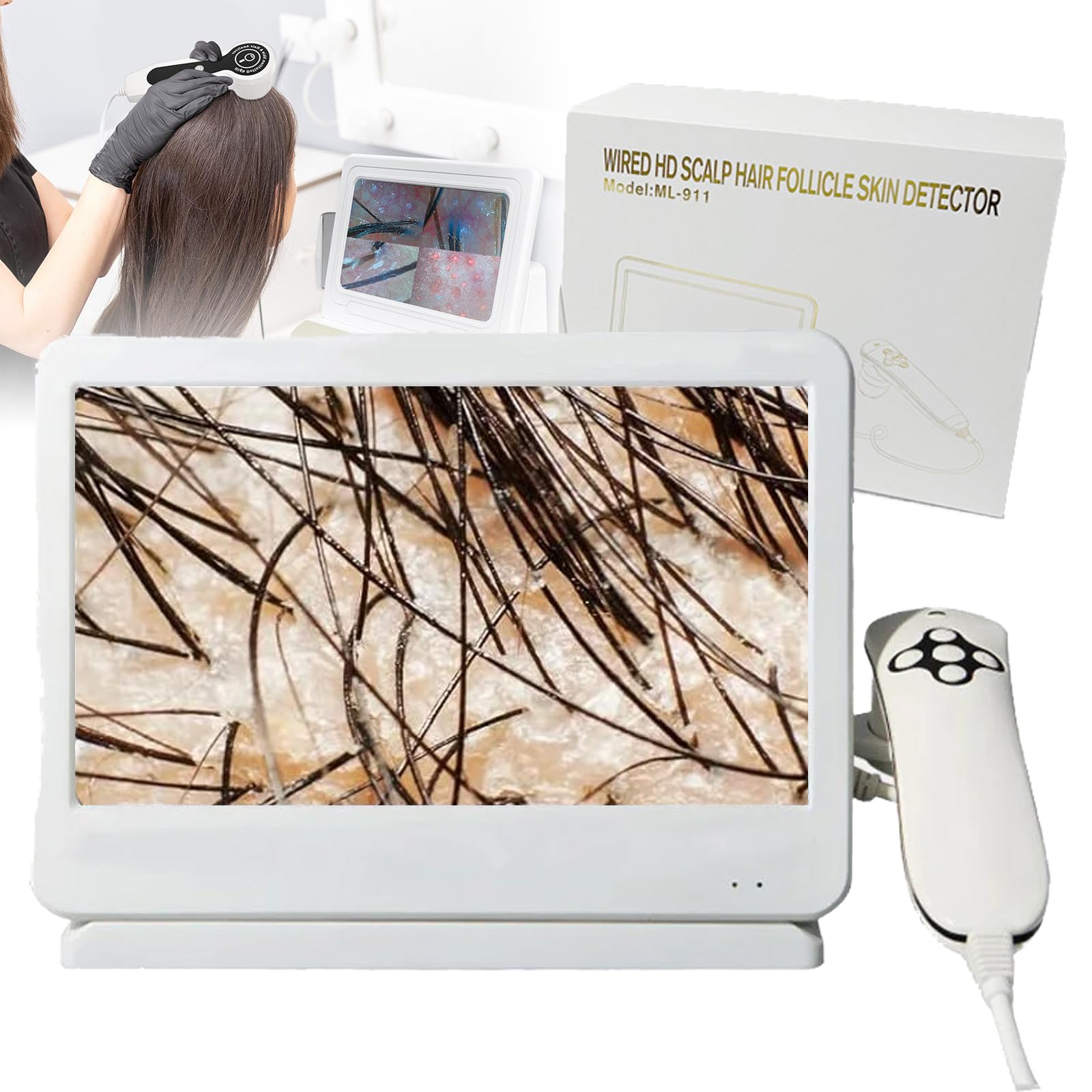 10,1-Zoll-Haut- Und Haaranalysegerät | 200-Fache Vergrößerung + 10 Megapixel + 4-Bildschirm-Vergleich; Professionelles Analysegerät