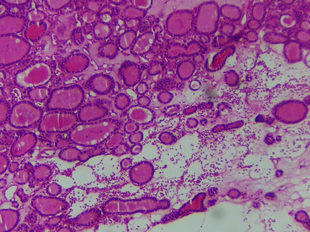 200PCS Pathology Prepared Microscope Slides for Medical Education