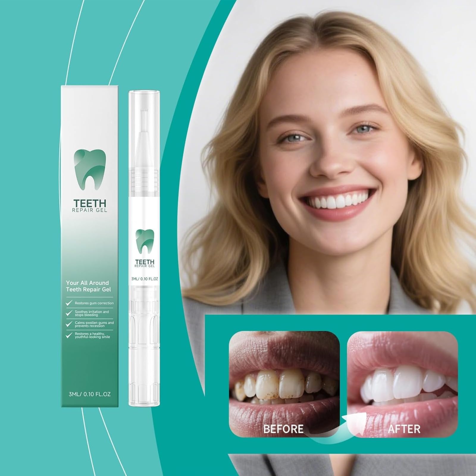 Gel de reparación de dientes, juego de reparación de encías, protector de encías al regresar las encías, lápiz esencial para blanquear los dientes, quitamanchas, limpieza bucal, protección de encías