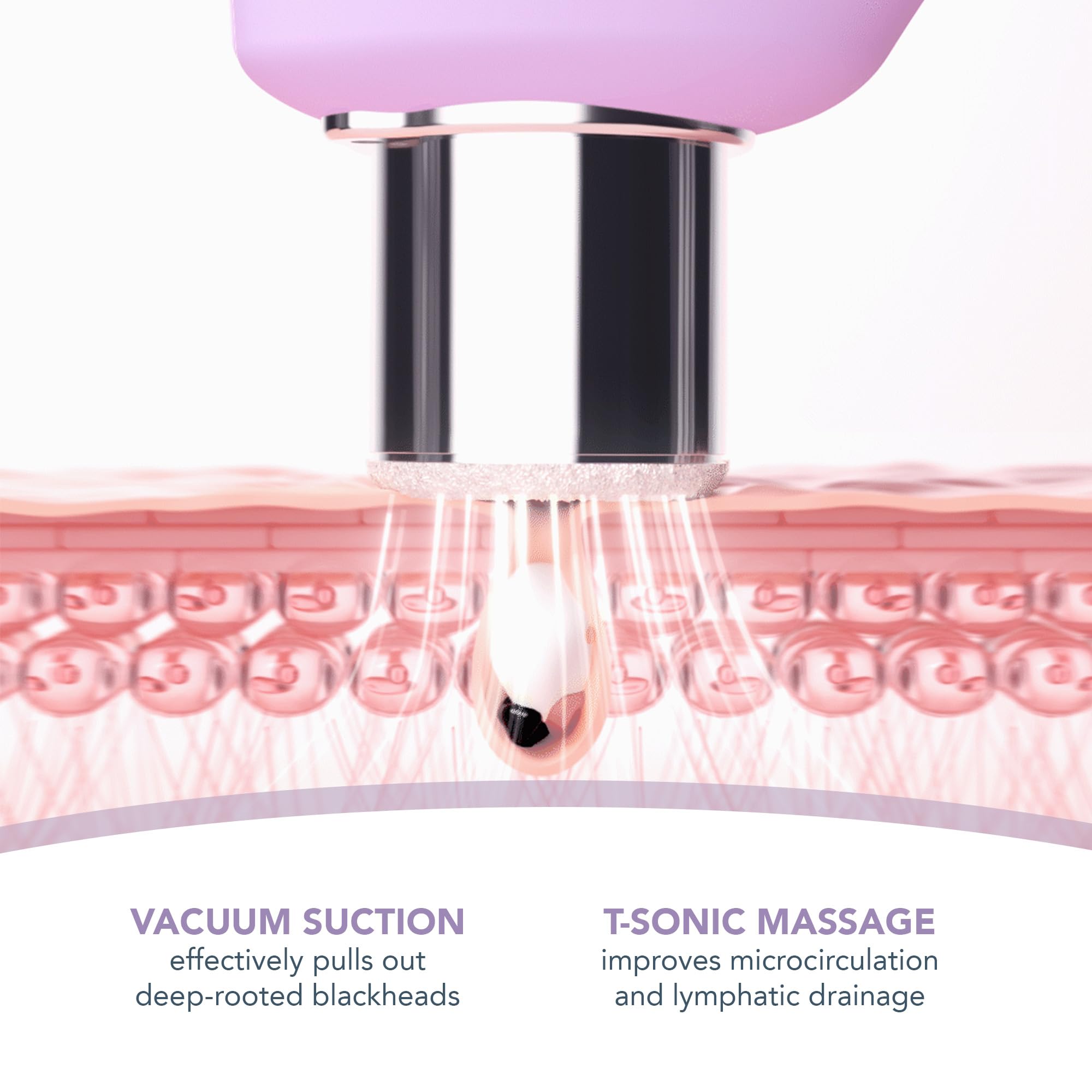 FOREO KIWI derma Dispositivo microdermoabrasione esfoliante levigante Aspiratore punti neri viso + Maschera pori punti neri 100g