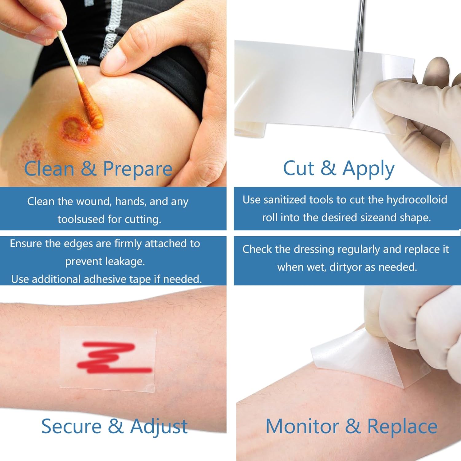 Hydrocolloid Roll for Wound Care – Cut-to-Size, Self-Adhesive Hydrocolloid Bandages for Burns, Blisters & Acne, Waterproof, Ultra-Absorbent, ER-Approved First Aid Essential 2 Rolls(2in*16ft)