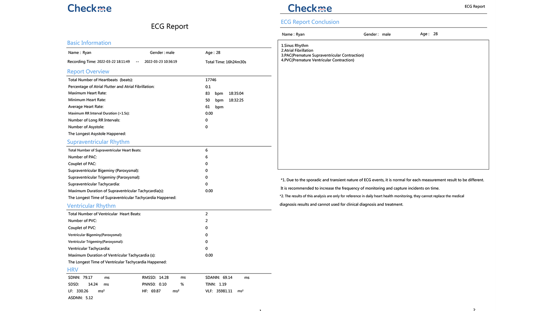 CheckMe 24h EKG Gerät Mit AI-Analyse – Brustgurt Oder Pflaster, Komfortabel, PC-Software & PDF-Bericht