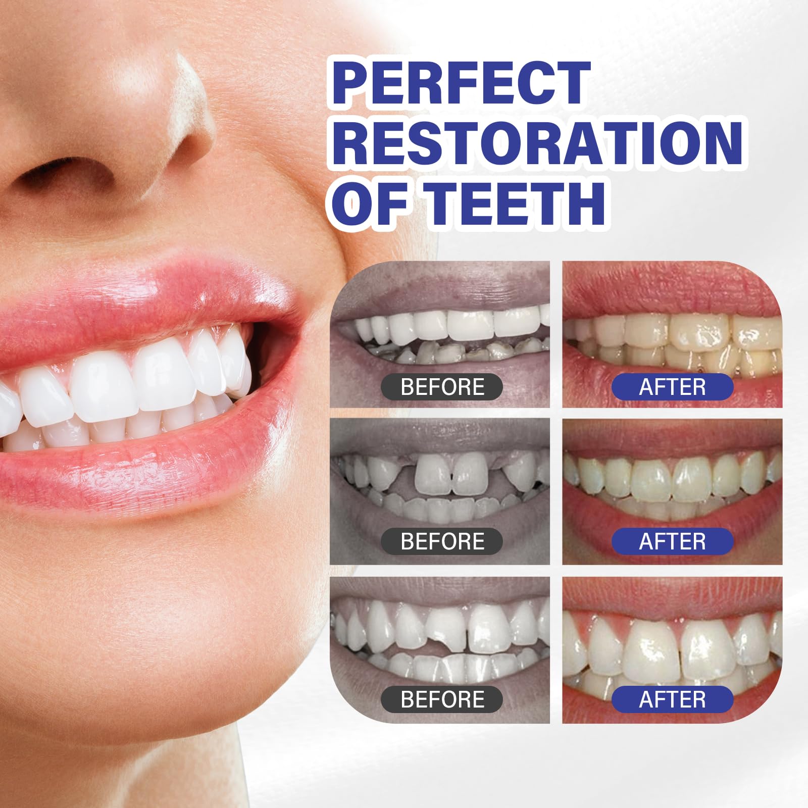 How To Use Dentek Temparin Max Tooth Filling And Crown, 55 OFF