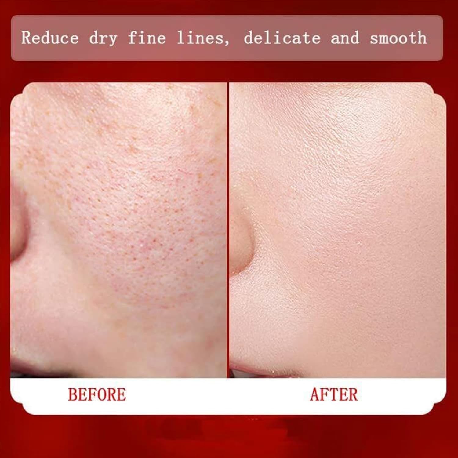 Dragon Blood Cream,Retinol Placenta Dragon Blood Cream,Retinol Placenta Royal Drago... - Image 4