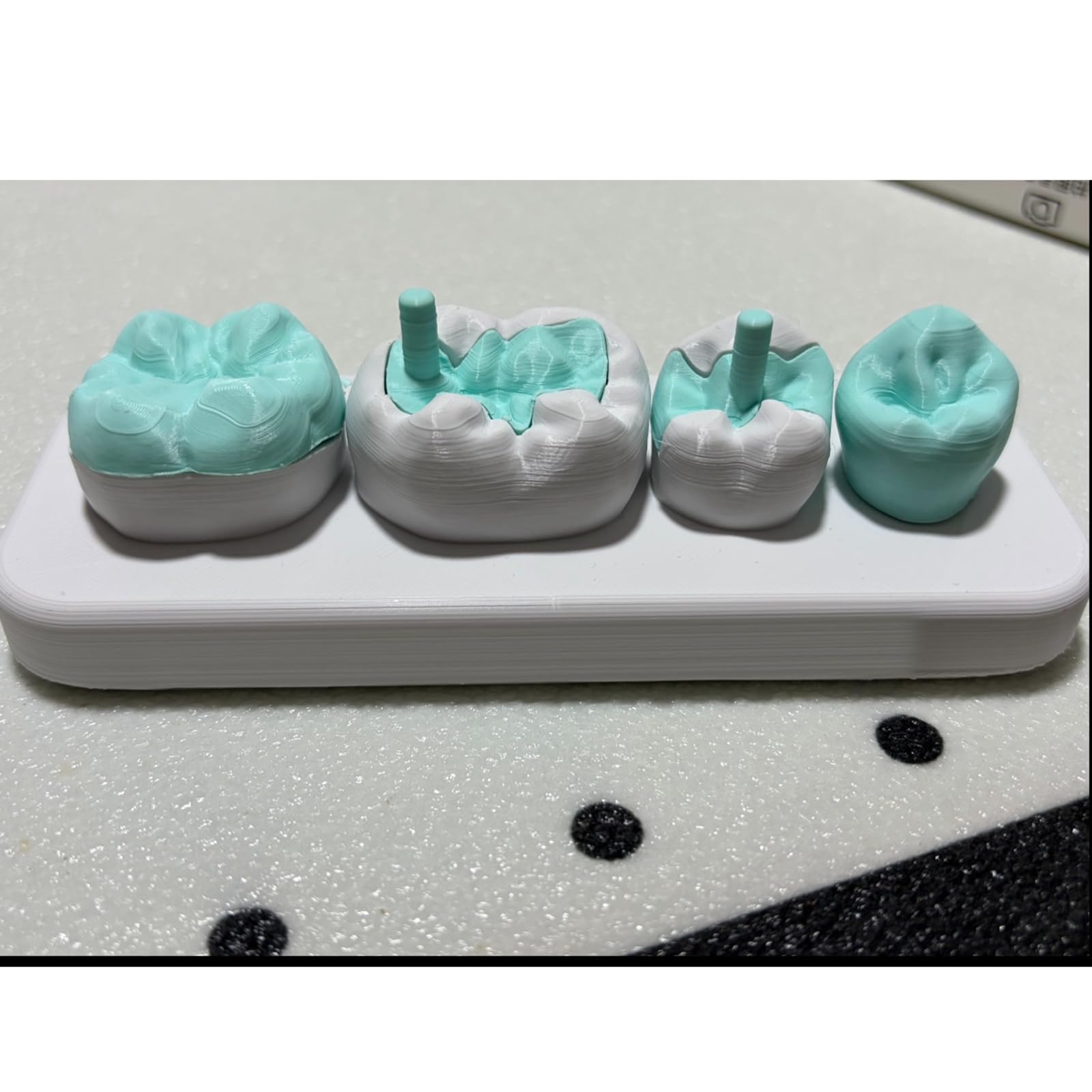 Modello di Intarsio e Onlay, Modello Didattico di Corona Completa con Attacco Magnetico, per la Comunicazione Dentista-Paziente