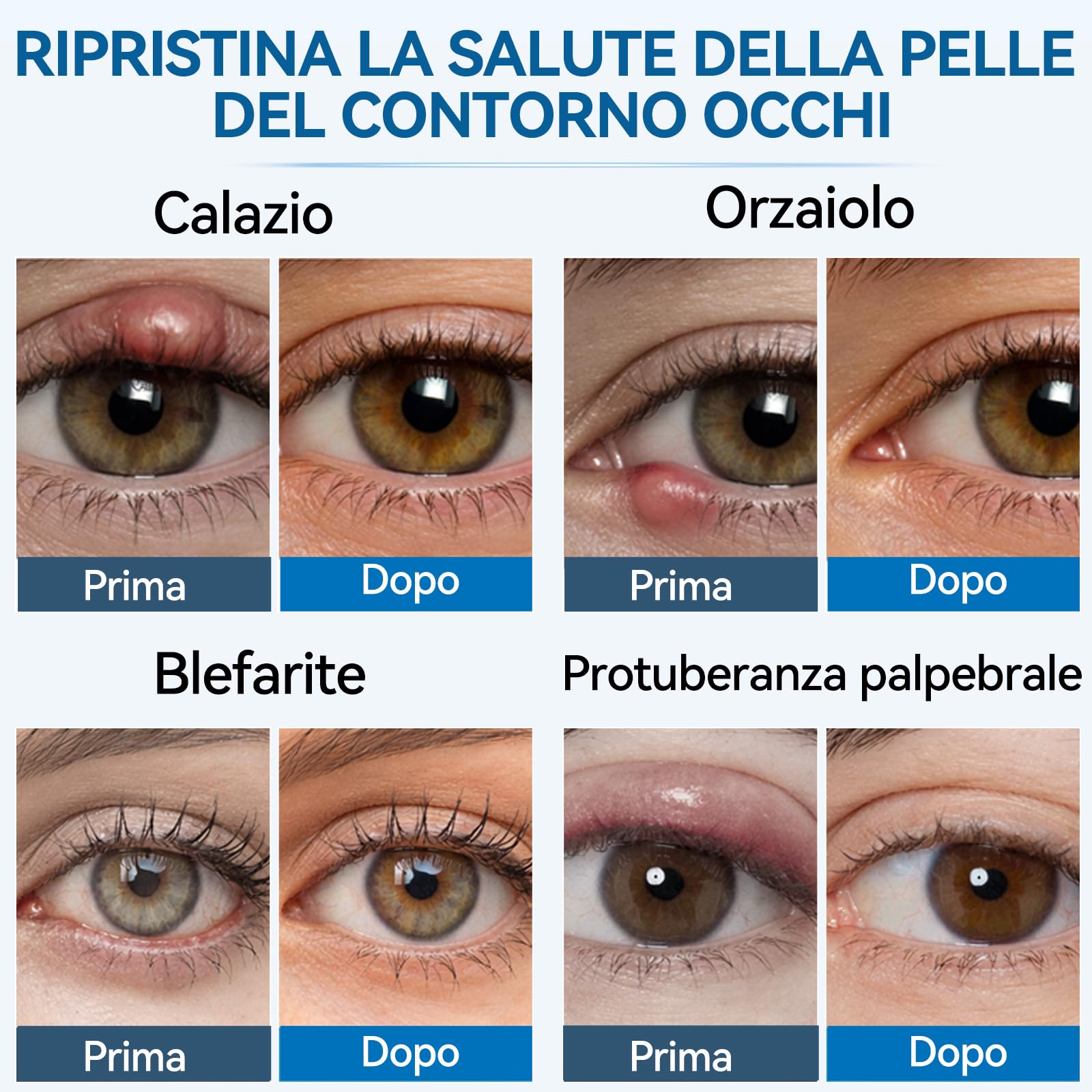 Siero per Palpebre 30 ml, Trattamento Naturale per Orzaiolo, Blefarite, Calazio e Occhi Secchi, Pulizia Delicata per Palpebre Irritate, Collirio Naturale Per una Corretta Igiene Palpebrale