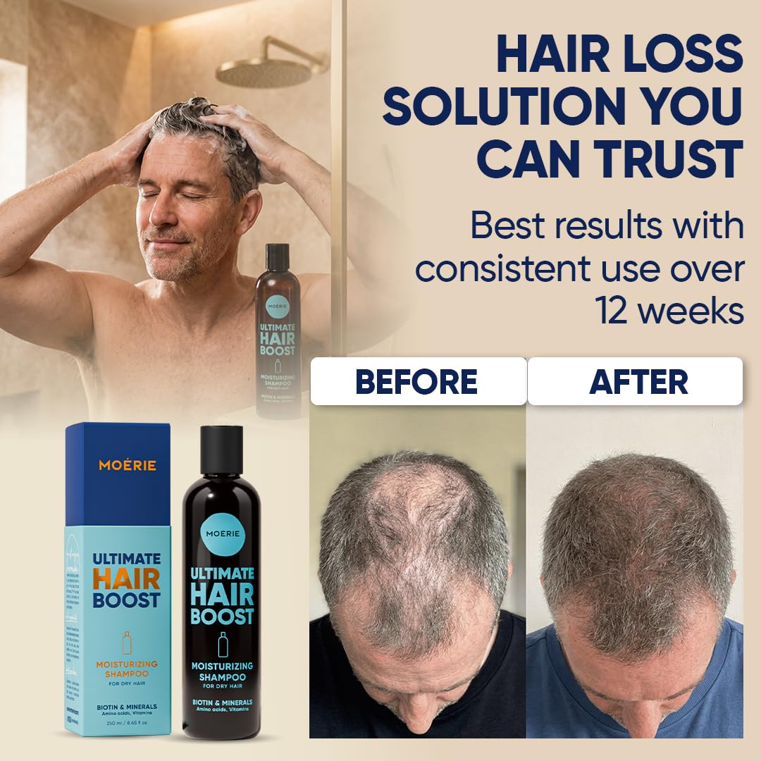 Moerie Ultimate Hair Growth Shampoo - Per capelli più lunghi, spessi e pieni - Prodotti volumizzanti vegani - Senza parabeni e silicone - Tutti i tipi di capelli - Idratante
