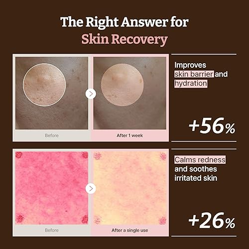 Miniatura 4 de Dr. Reju-All Advanced PDRN Rejuvenating Cream Max  99% Pure Salmon DNA Gel Type Face Moisturizer  Optimal 1200ppm for Glass Skin & Plumping  Korean
