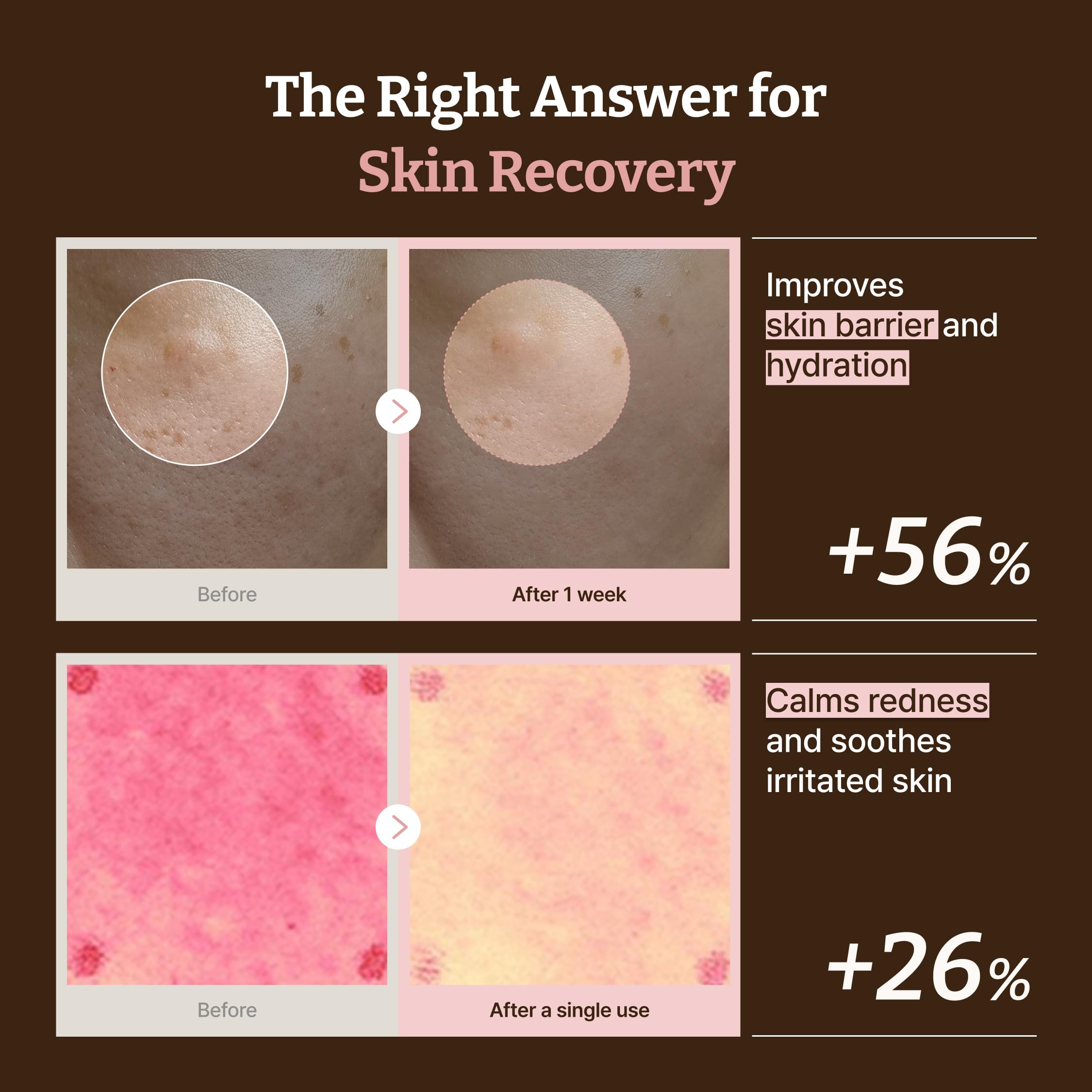 Amazon.com: Dr.Reju-All Advanced PDRN Rejuvenating Cream Max – 99
