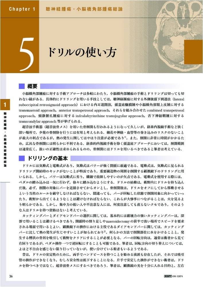 聴神経腫瘍・小脳橋角部腫瘍の手術とマネージメント | 河野 道宏