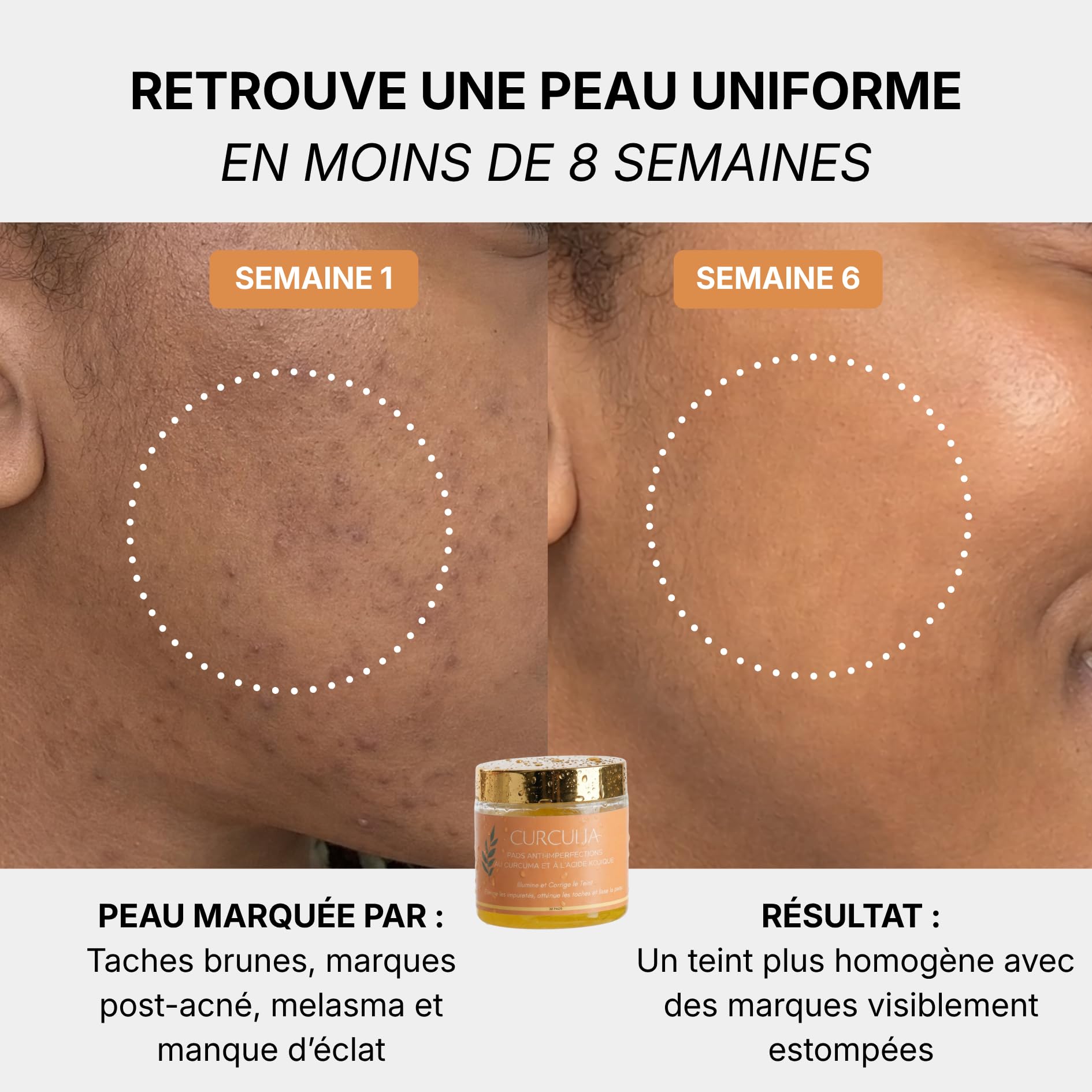 Pads Anti-Imperfections au Curcuma - 250g