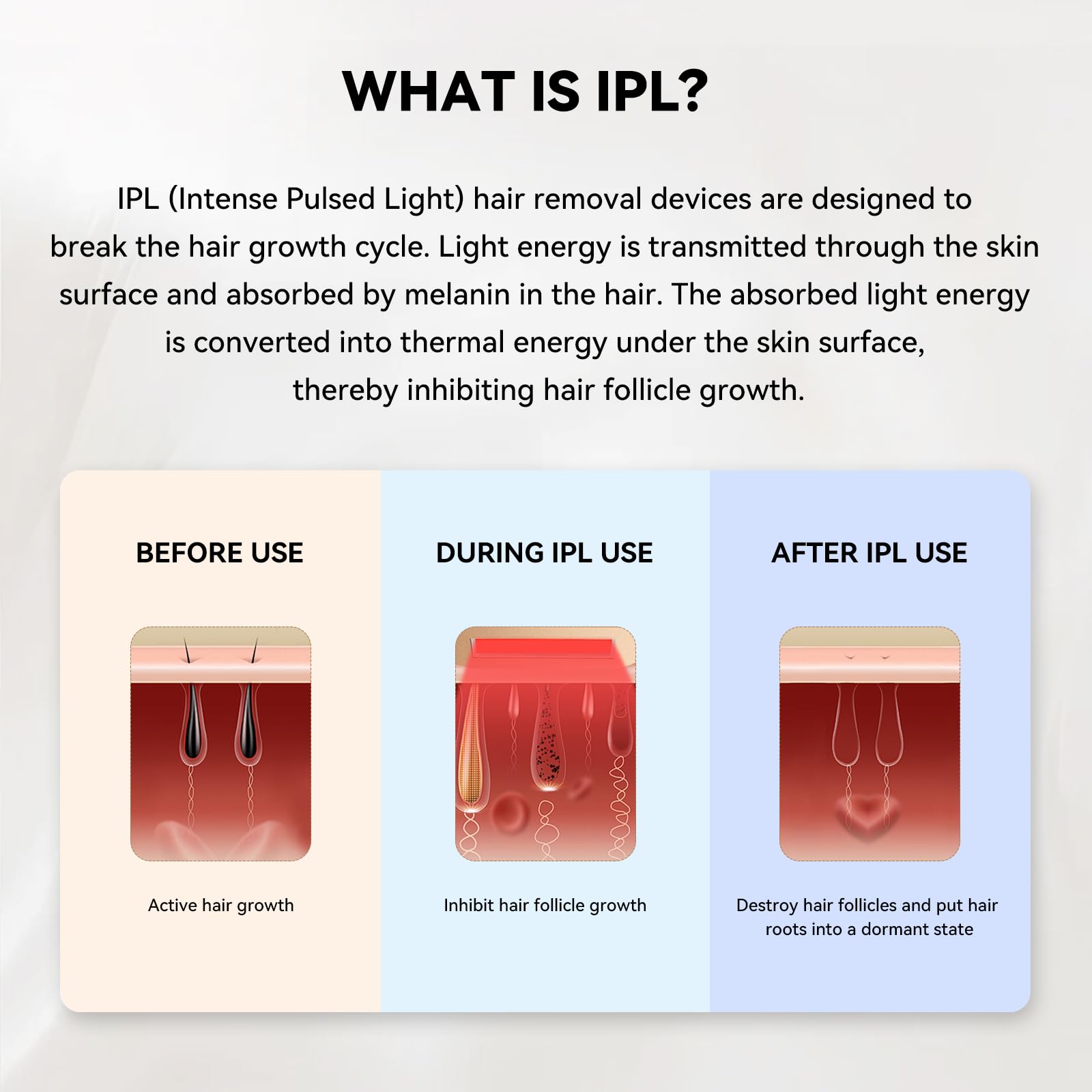 Mlay T14 IPL Epiliergerät – 96,39% Haarreduktion Nach 4 Wochen, 500 Mio. Blitze, Schmerzfrei Mit Kühlsystem (Kein Laser), Für Alle Hauttypen (Blue)