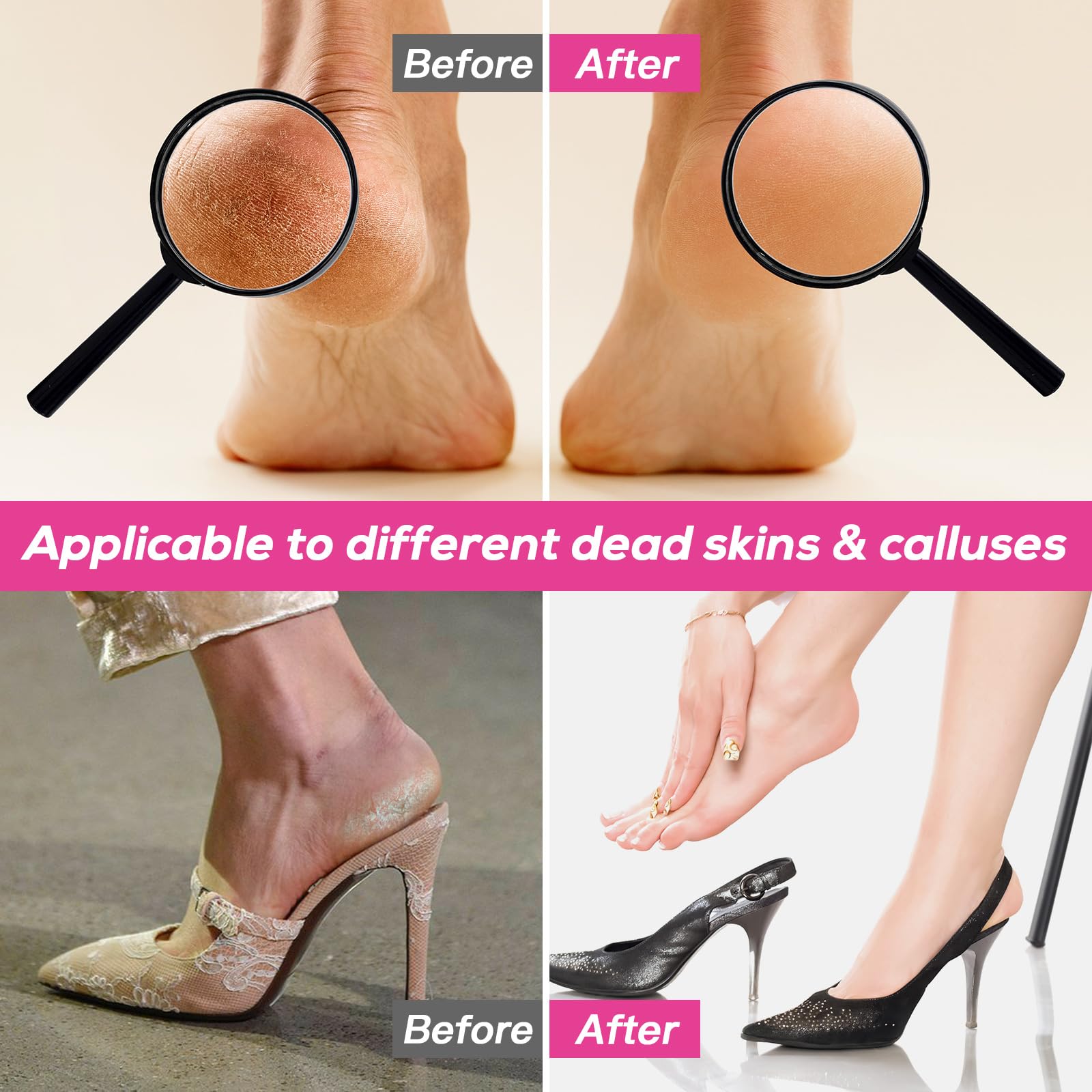 Electric Foot Callus Remover, Adjustable Rotatable Electronic Foot Dead Skin Remover Callus Remover Tool for Home & Nail Salon with 60 pcs Replacement Sandpaper Disk,Pink