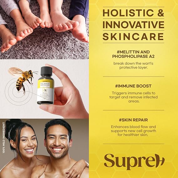 Fast-Acting Bee Venom Wart Remover: Verruca Treatment and Corn Remover for Feet - Wart Removal for Plantar Wart and Common Wart