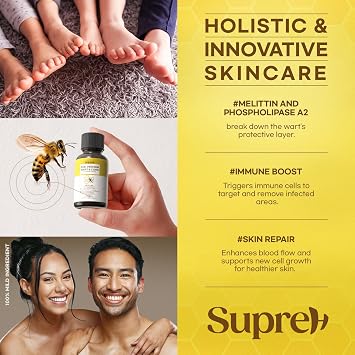 Fast-Acting Bee Venom Wart Remover: Verruca Treatment and Corn Remover for Feet - Wart Removal for Plantar Wart and Common Wart