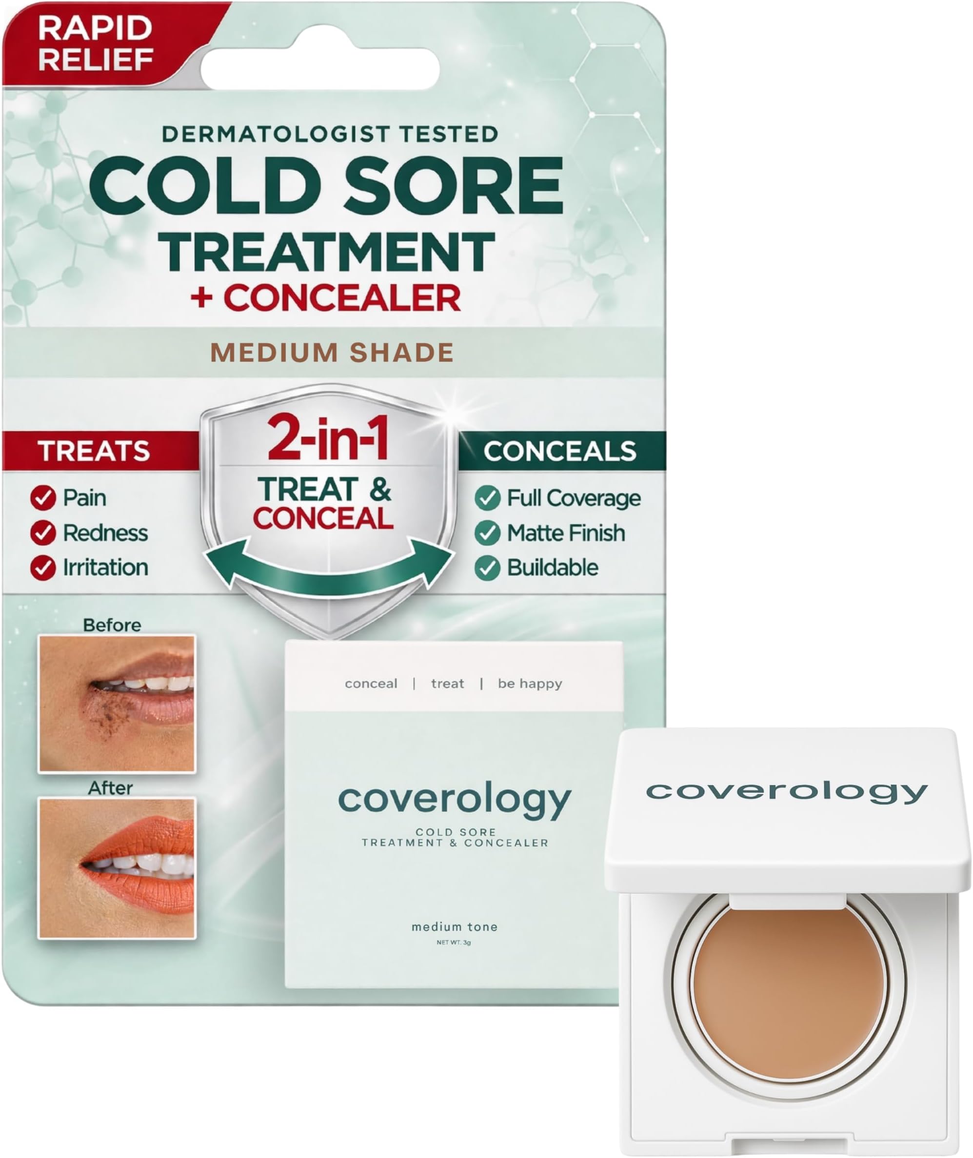 Coverology Cold Sore Treatment & Cold Sore Concealer - The Best Full Coverage Cold Sore Cover Up Makeup to Help Disguise and Soothe - Medium
