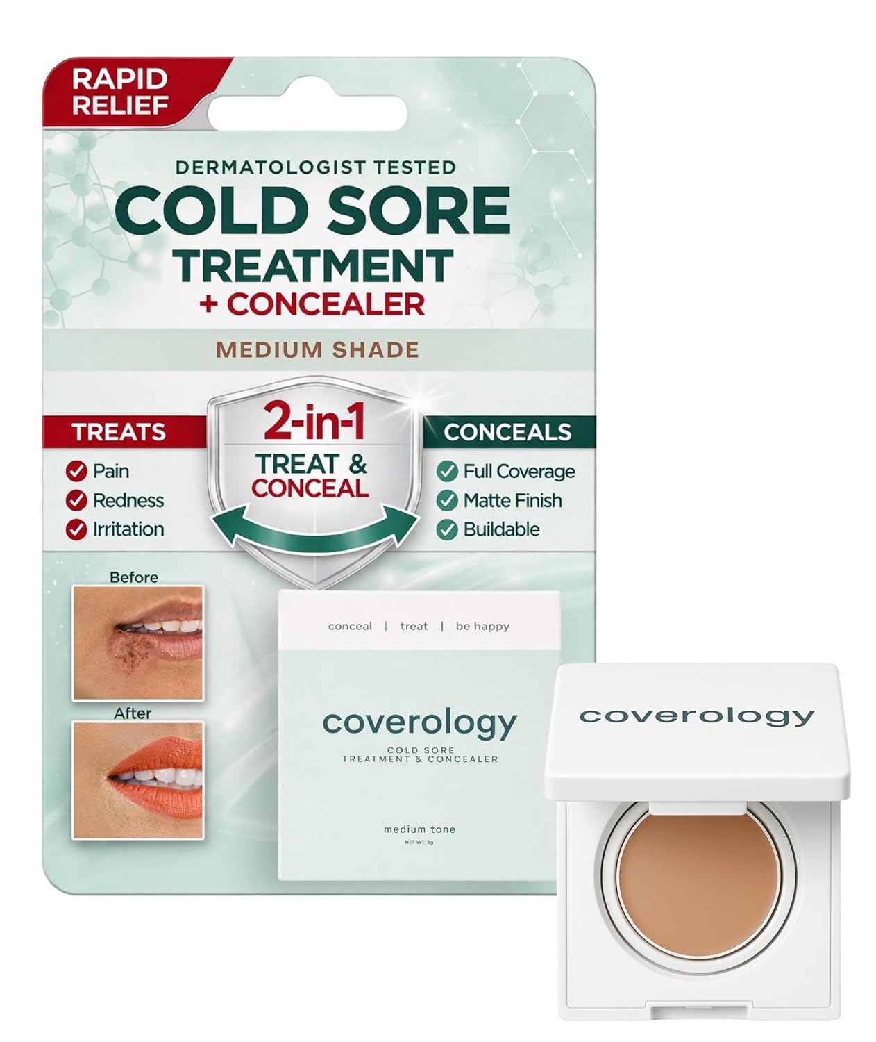 Coverology Cold Sore Treatment & Cold Sore Concealer - The Best Full Coverage Cold Sore Cover Up Makeup to Help Disguise and Soothe - Medium