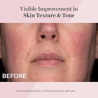 StriVectin Advanced Retinol, Targets Visible Signs of Aging for Healthier Skin