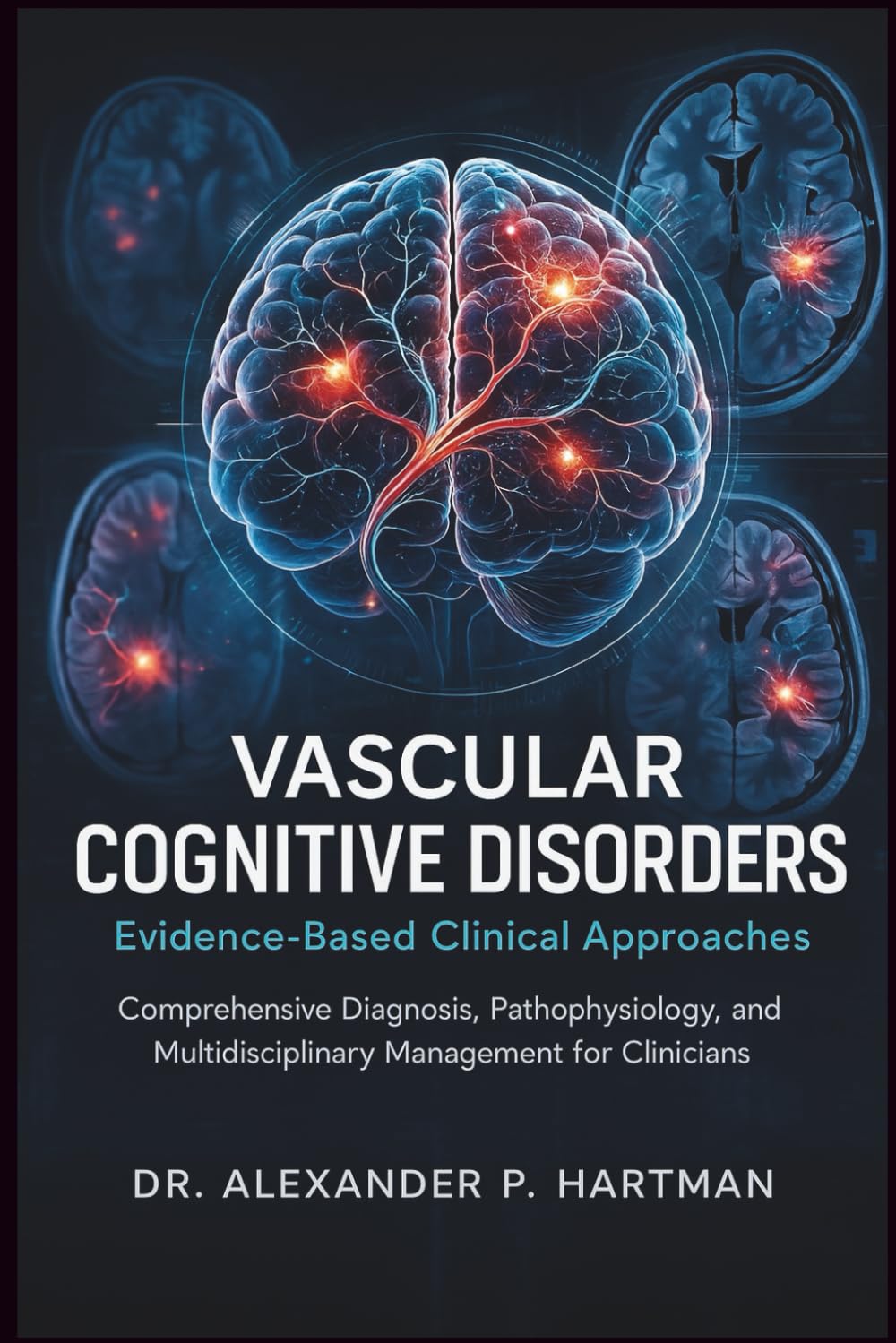 Vascular Cognitive Disorders: Evidence-Based Clinical Approaches: Comprehensive Diagnosis, Pathophysiology, and Multidisciplinary Management for Clinicians