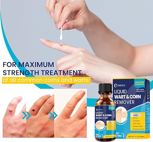 Miniatura 4 de Removedor de verrugas con ácido salicílico MEOLY Eliminación rápida de verrugas de máxima potencia para hombres y mujeres - Verruga plantar, verruga