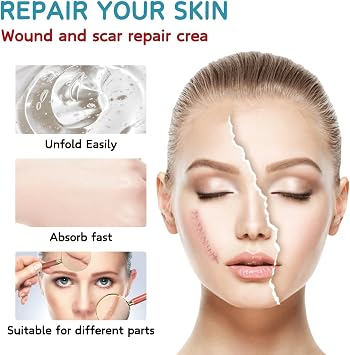 Scar Gel: The ultimate scar - removal remedy for all. Works on every body part, treating old and new scars from acne, surgery, burns, and stretch marks. Its formula smooths, firms, fades scars, and of