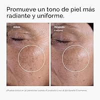 Vista 2 de The Ordinary Glycolic Acid 7% Exfoliating Toner, Brightening and Smoothing Daily Toner for More Even-Looking Skin Tone