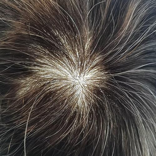 Miniatura 10 de Toupee - Sistema de cabello completo de poliéster para hombre, tupé inyectado de poliuretano duradero, unidades de cabello humano europeo, pelucas