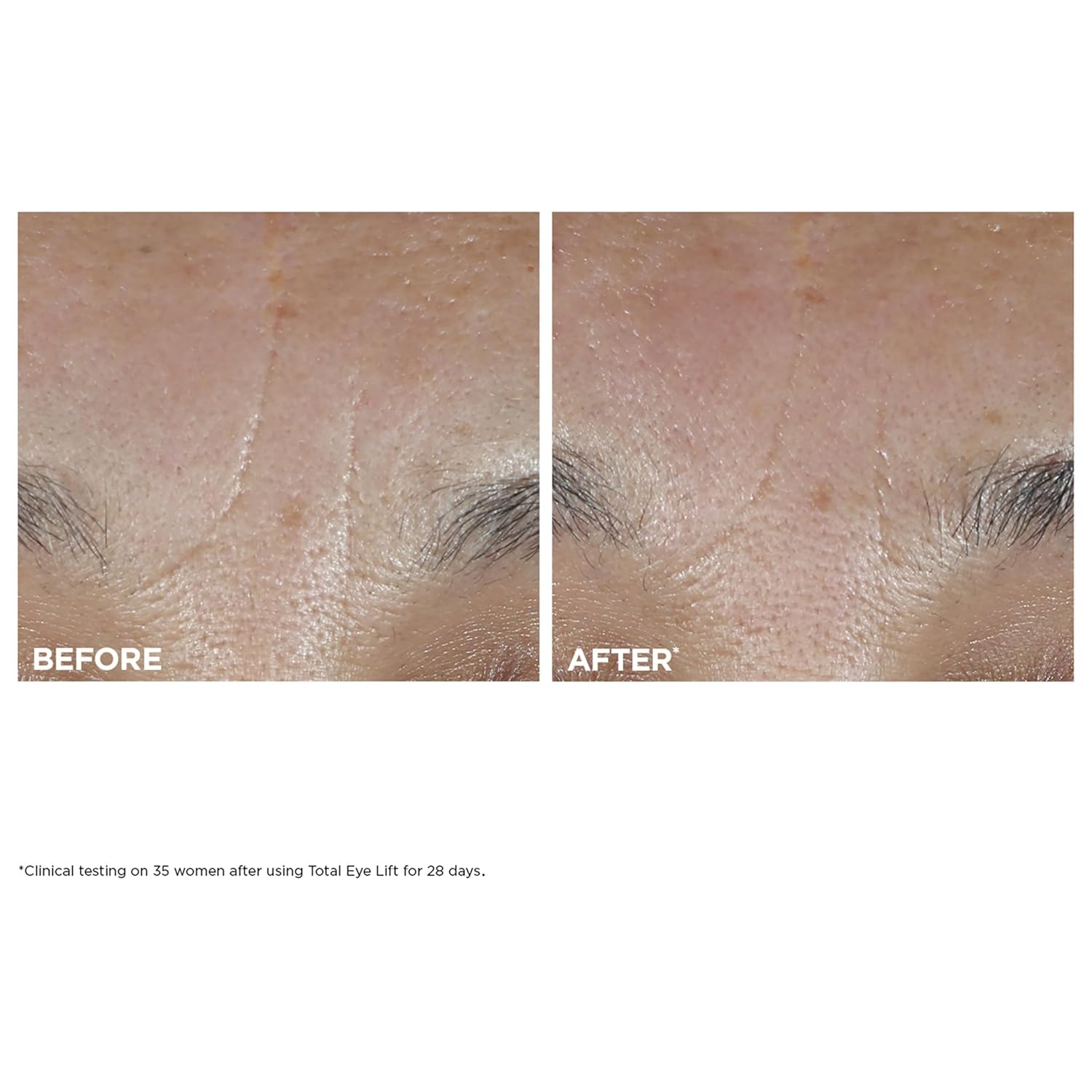 Clarins NEW Total Eye Lift | Anti Aging Eye Cream | Targets Wrinkles, Crow's Feet, Dark Circles and Puffiness For a Visible Eye Lift in 30 Seconds | REFILLABLE - Image 9