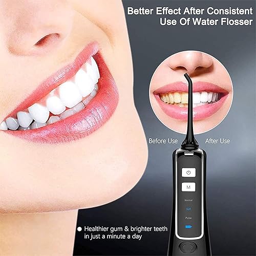 Miniatura 3 de Irrigador dental inalámbrico con irrigador dental dental limpiador dental IPX7 impermeable limpiador de dientes con 3 modos y tanque de agua