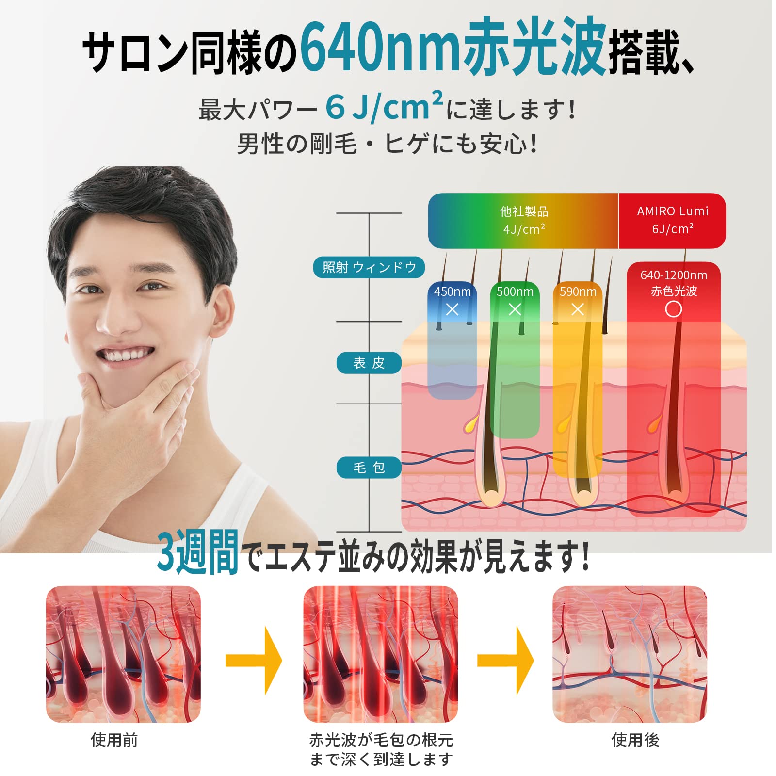 Amazon | AMIRO 光美容器 脱毛器 最高峰パワー6J/cm² 男性剛毛・ヒゲ