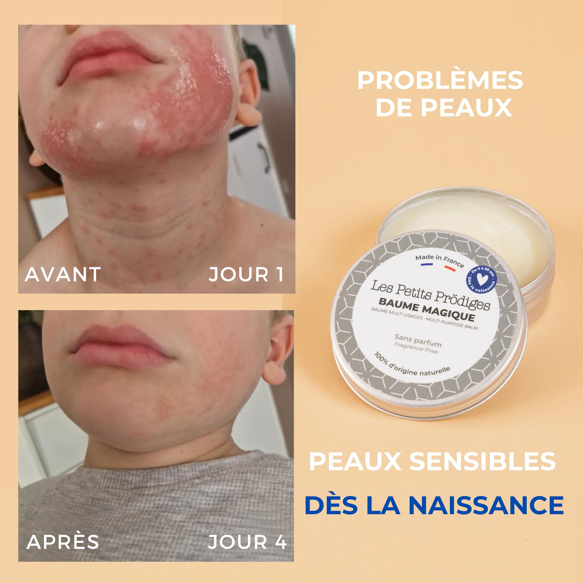 Le baume sans odeur - LES PETITS PRÖDIGES