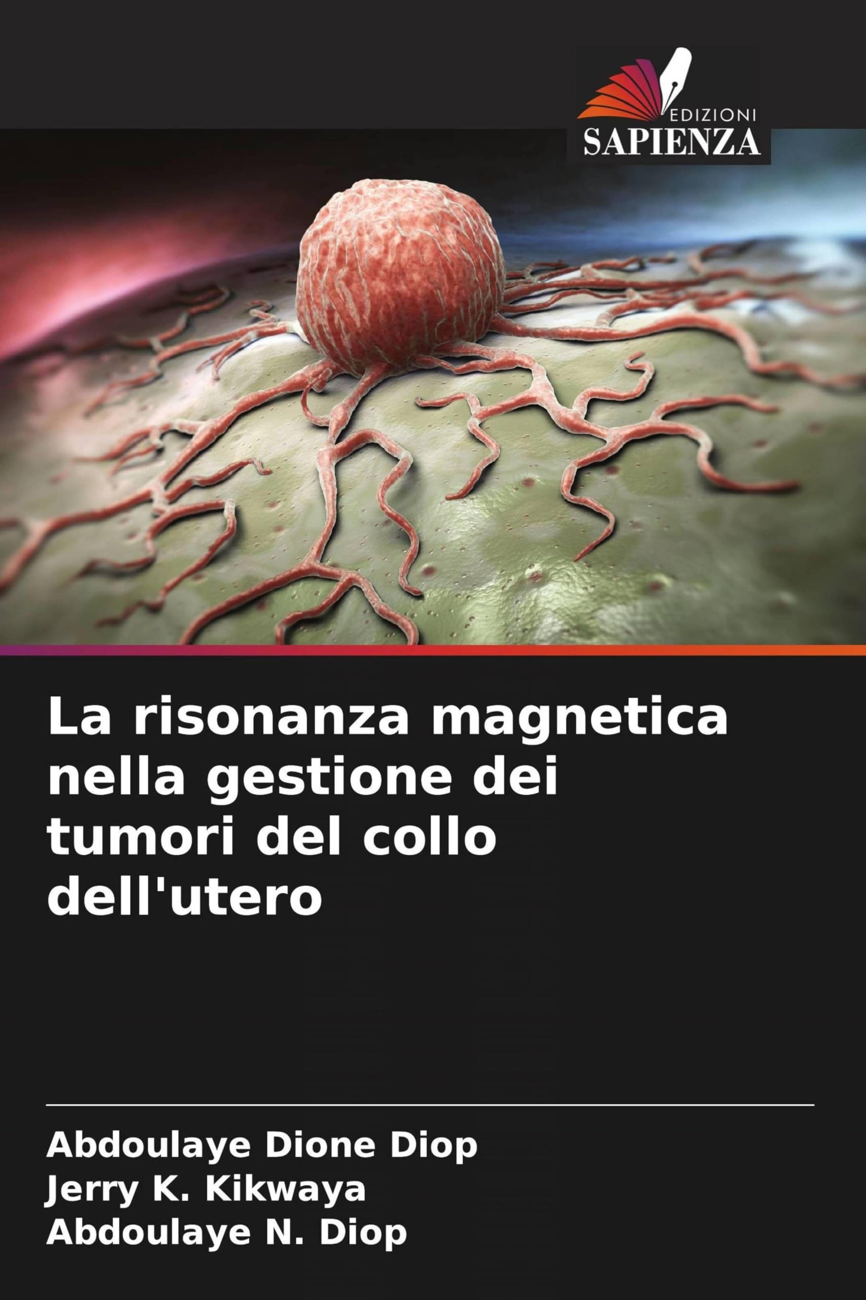 La risonanza magnetica nella gestione dei tumori del collo dell'utero