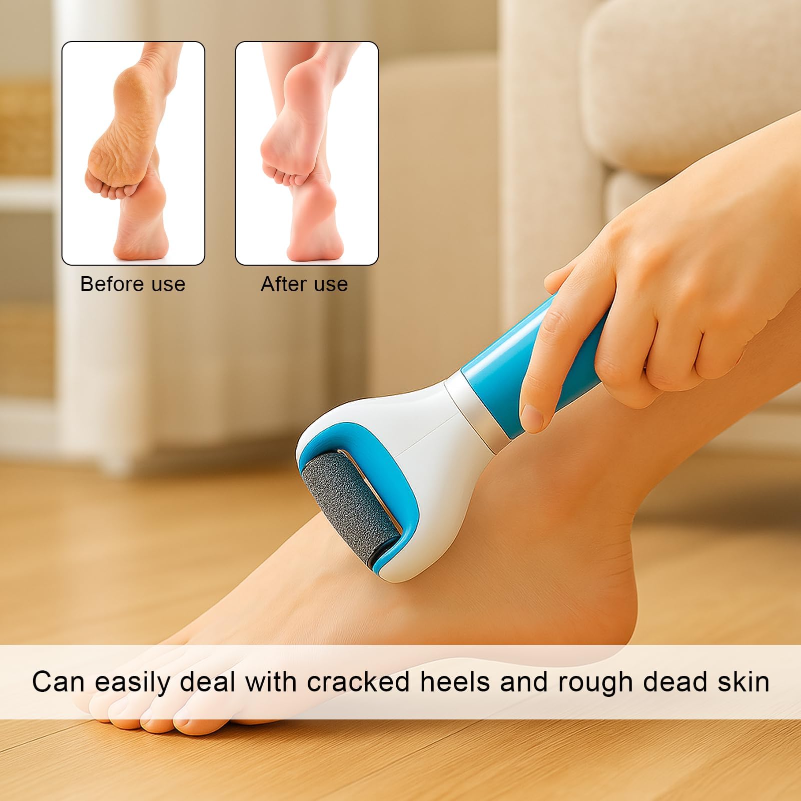 Set di 10 Rulli di Ricambio per Rimozione Calli, Pietra Pomice per Piedi, 3 Livelli di Rugosità, Compatibile con Dr Scholl
