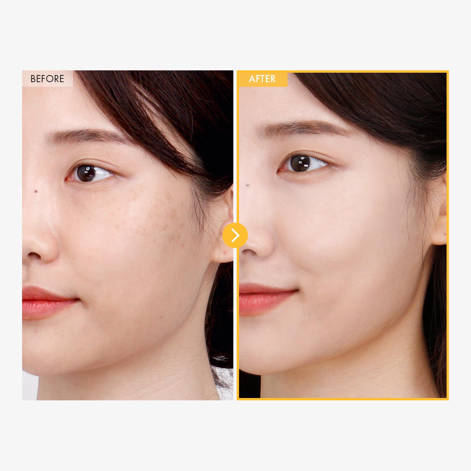 TOSOWOONG 8 Days Spot Cream, Dark Spot Remover for Face Age Spot, Sun Spot, Freckles, Melasma, Brown Spot Serum - Image 3