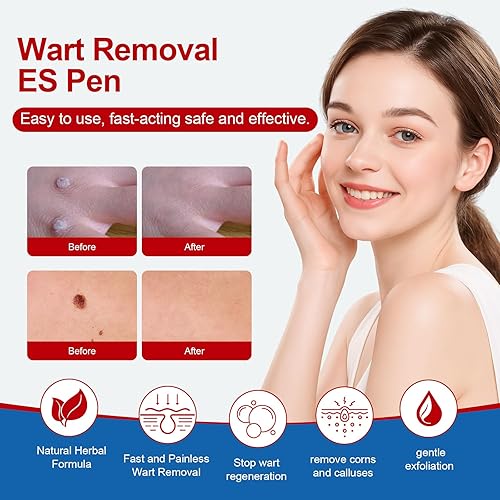 Miniatura 2 de BEHATMH Paquete de 3 removedor de verrugas con punta de precisión, ácido salicílico de máxima resistencia para verrugas comunes y plantares,