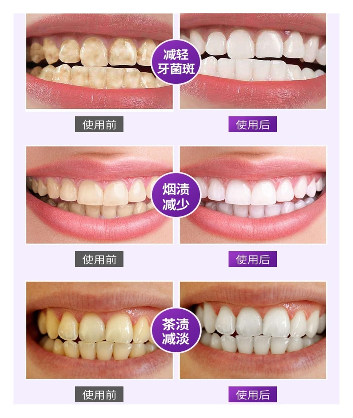 Pasta de Dientes Blanqueadora 120g | Limpia, elimina el color amarillento y las manchas, ilumina los dientes. Se dirige a las manchas de tabaco, té y café.(3pcs)