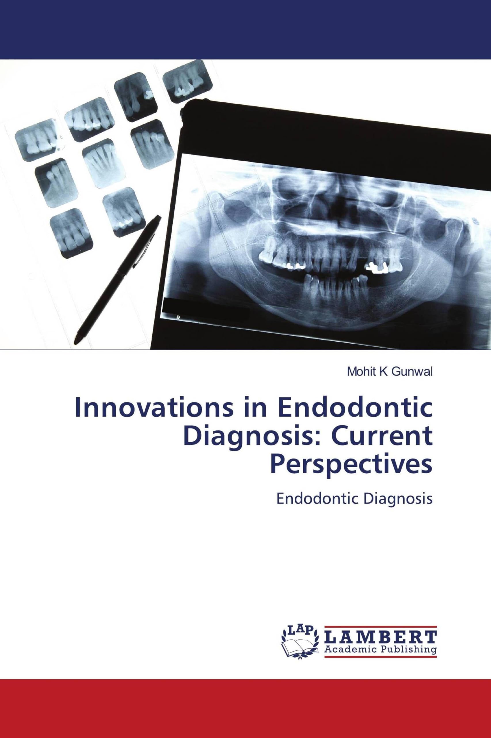Innovations in Endodontic Diagnosis: Current Perspectives: Endodontic Diagnosis
