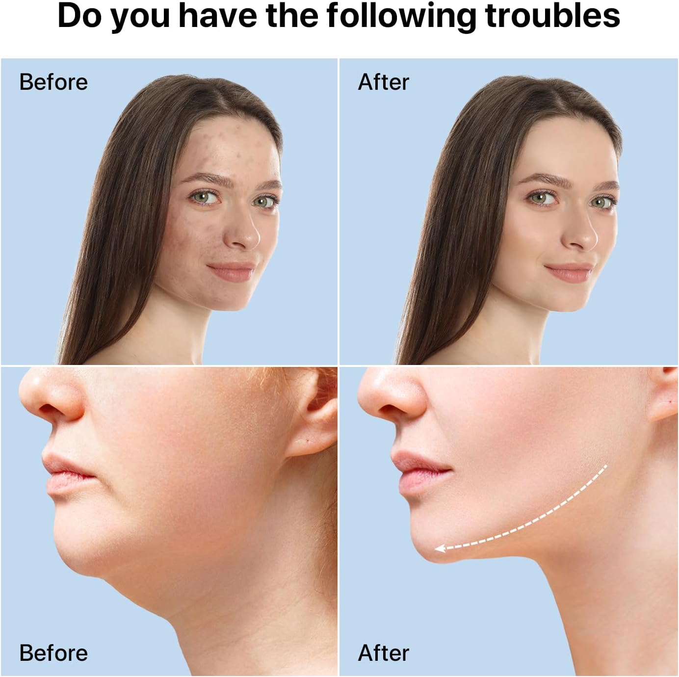 Red Light Therapy for Face and Neck, 8-in-1 Led Face Neck Massager for Skin Care