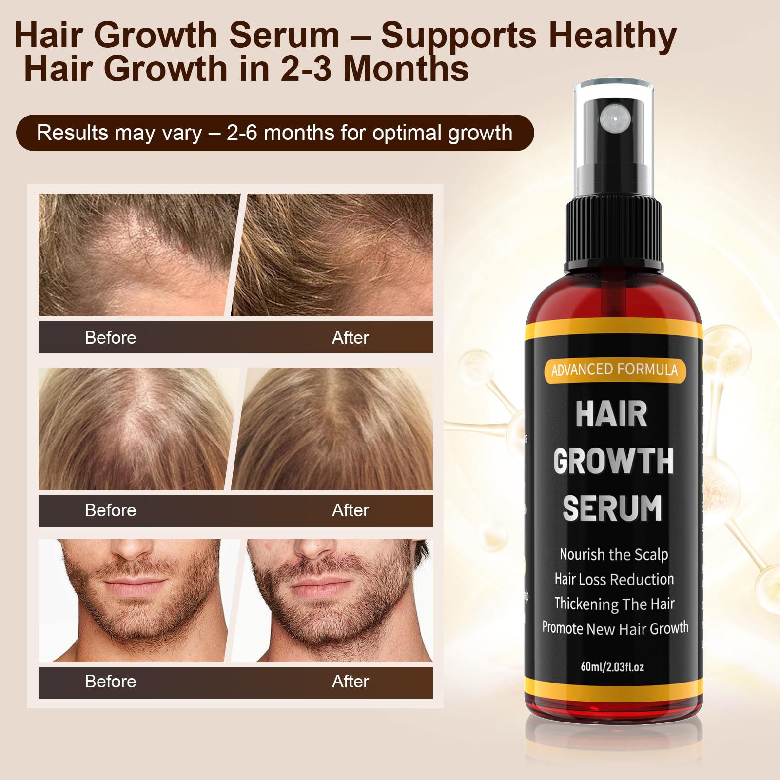Haarwachstum Serum Spray Für Männer/Frauen, Haarwachstum beschleunigen, haarausfall frau Verhindern, Mit Rosmarinöl, Rizinusöl Und Biotin Haaröl Wachstum, Bartwuchsmittel 60ml(3er Pack)