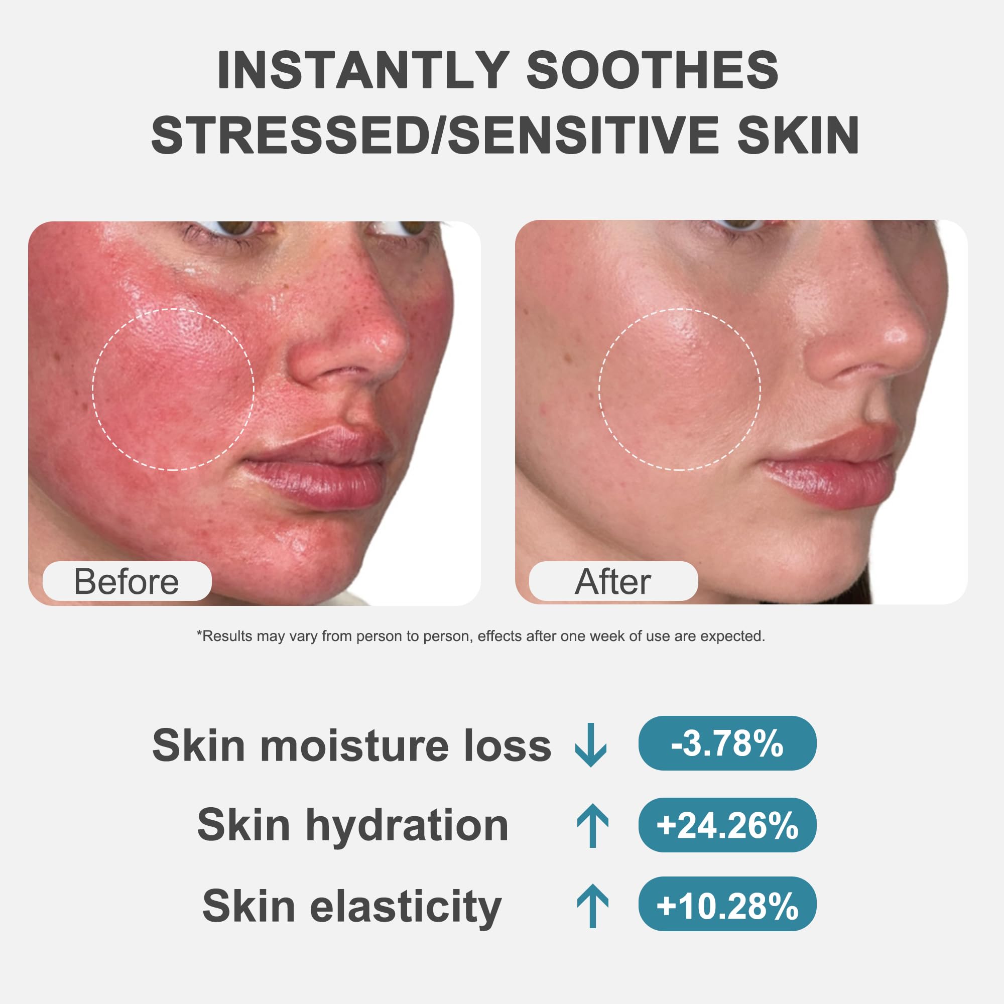 美容液 Ms. ADVANCED MICRONEEDLE REPAIR CREAM Ms. ADVANCED MICRONEEDLE REPAIR CREAM 【公式通販】